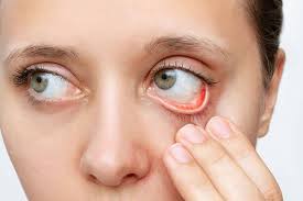 Choosing Cataract Removal Surgery